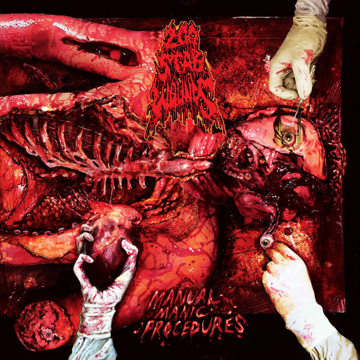 200 STAB WOUNDS - MANUAL MANIC PROCEDURE Vinyl LP